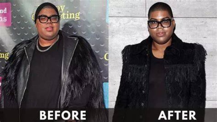 BEFORE & AFTER E.J. Johnson's lost 50 lbs. and counting since gastric