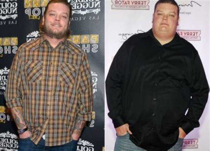 Big Hoss Weight Loss Surgery WeightLossLook