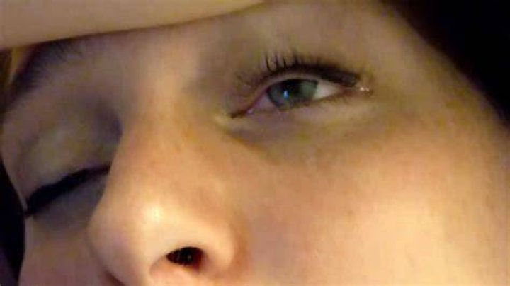 Crazy Weird Eyeball YouTube