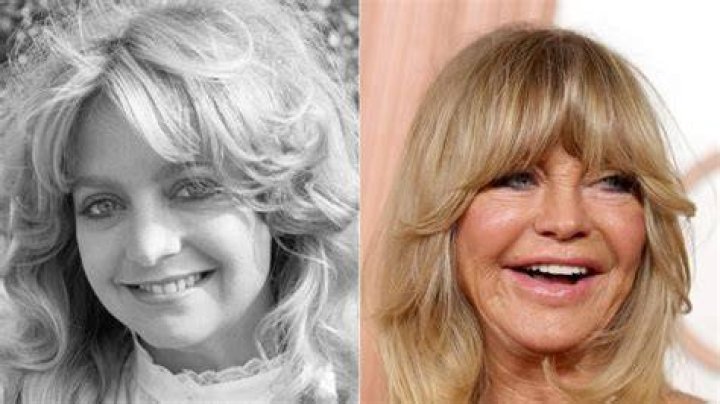 Did Goldie Hawn Get Plastic Surgery in 2017? Experts Weigh In!
