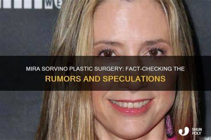Did Mira Sorvino Undergo Plastic Surgery? How Did She Conceal the Wrinkles?
