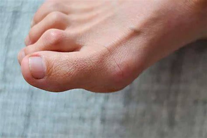 It starts in my toes, and I crinkle my nose. Wherever it goes I always