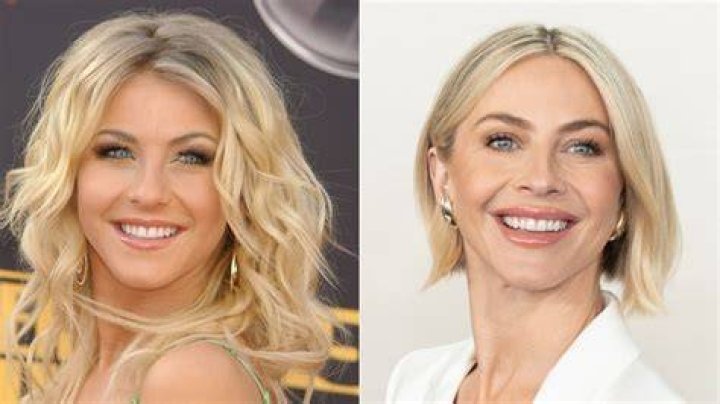 Julianne Hough before and after plastic surgery (3) Celebrity plastic