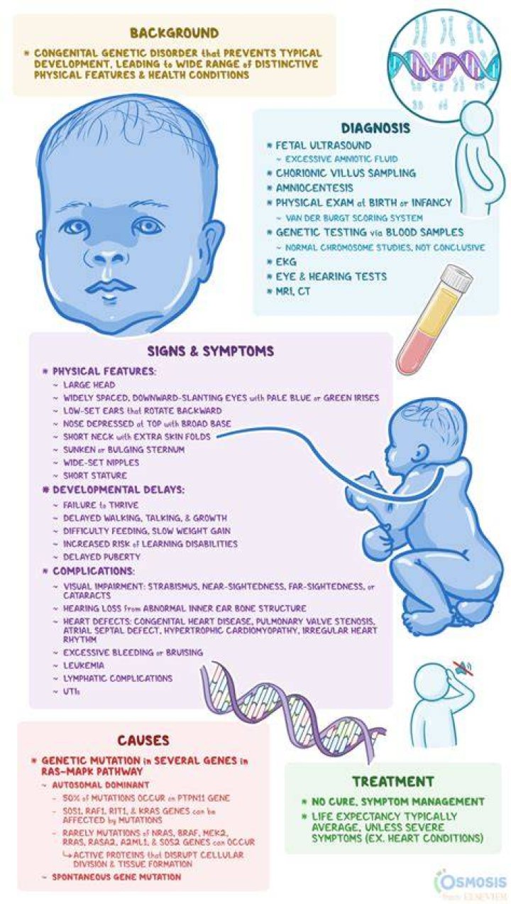 Noonan Syndrome AAFP