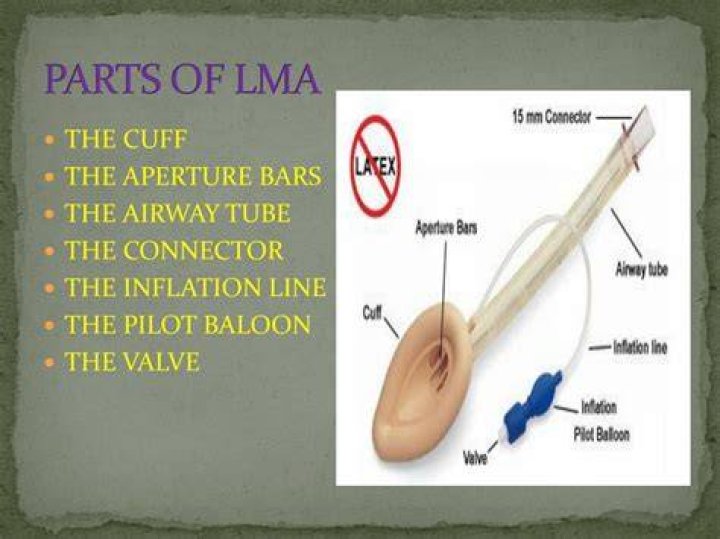 PPT LARYNGEAL MASK AIRWAY (LMA) PowerPoint Presentation, free