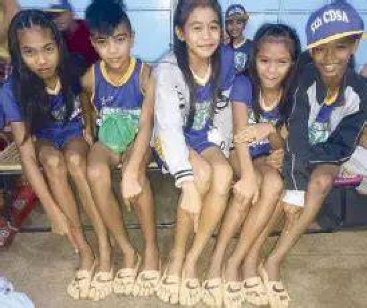 Support snowballs for barefoot runner